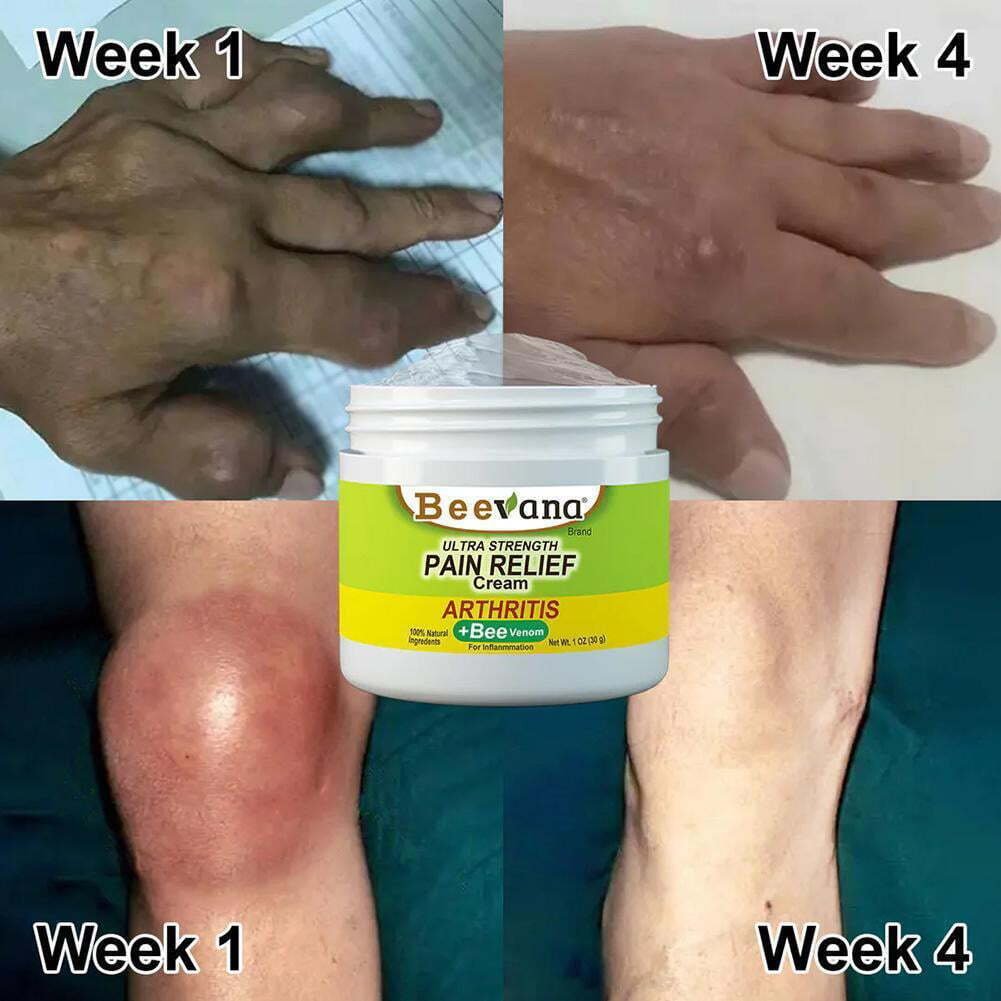 (Pack Of 3) BeeTherapy™ #1 Bee Venom Pain Relief Cream Buy 1 Get 2 Free!! | ⭐️⭐️⭐️⭐️ 4.9/5 Reviews
